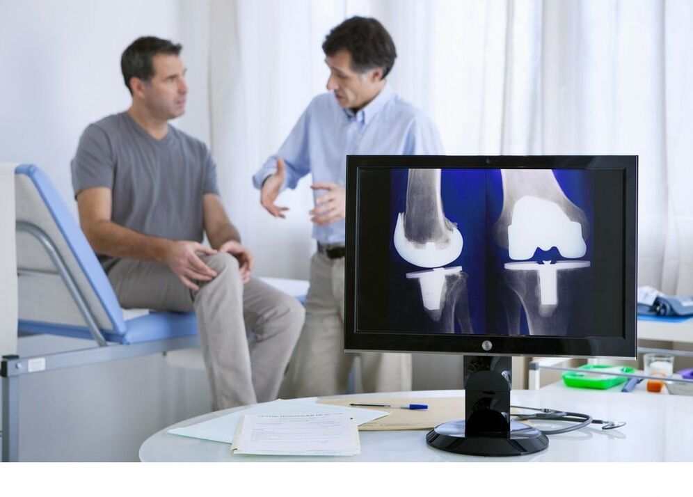 Artigies du genou Arthrose dans l'image X -RAY
